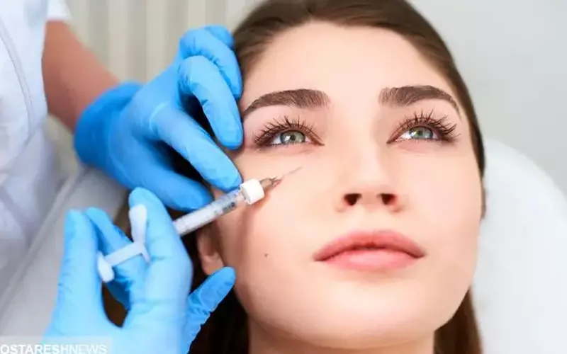 تزریق فیلر (ژل) زیر چشم: راه‌حلی پرطرفدار برای رفع تیرگی و گودی چشم‌ها